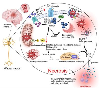 The NLRP3 inflammasome in ischemic stroke